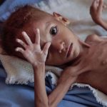 Protracted war in Yemen has killed or maimed 10,000 children: UNICEF