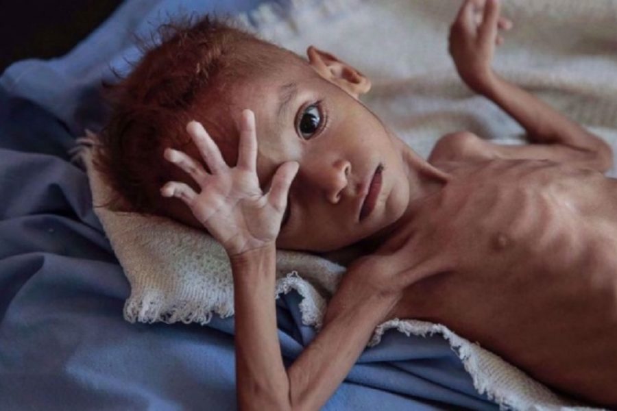 Protracted war in Yemen has killed or maimed 10,000 children: UNICEF
