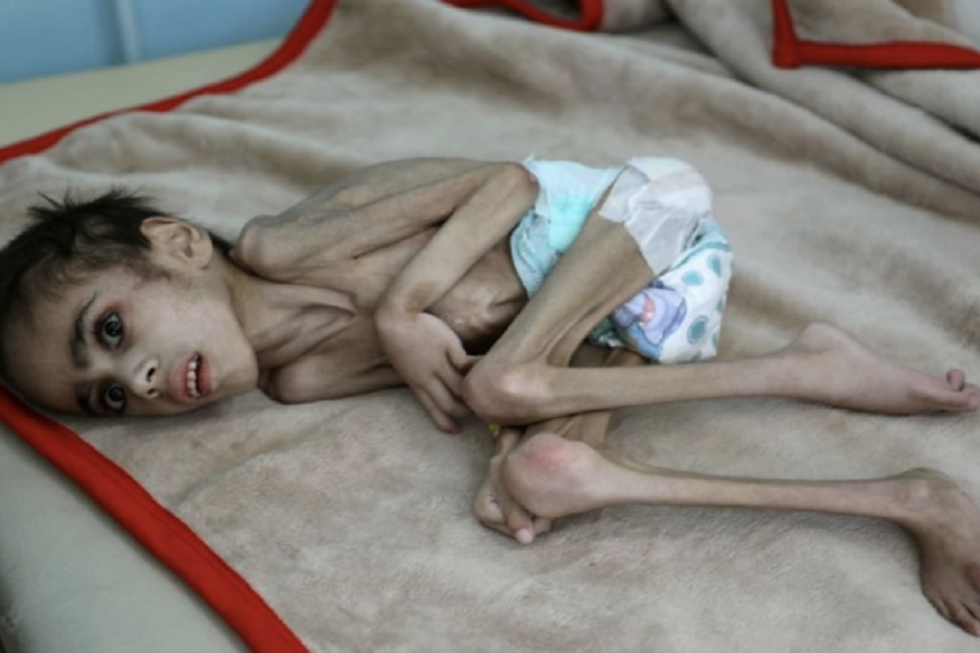 Yemen warns of severe attacks in UAE if it threatens to starve civilians