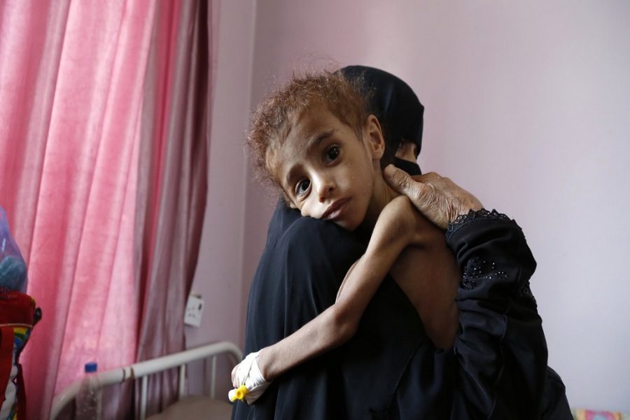 Katika kivuli cha mwendelezo wa kuzingirwa, watoto wa Yemen wanakufa