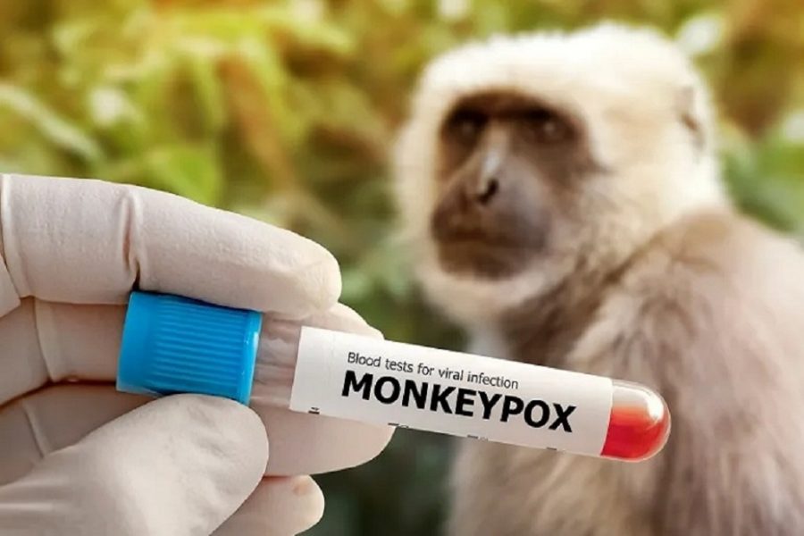 Shirika la Afya Dunia (WHO): Mpox sio “Covid” mpya