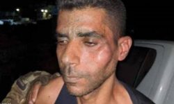 گرفتاری کے بعد مفرور فلسطینی پراسرائیلی جلادوں کا ہولناک تشدد