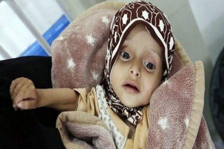 محاصرہ، یمن کے خلاف امریکہ کا ظالمانہ ہتھیار