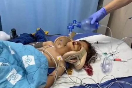 یہودی شرپسند نے4 سالہ فلسطینی بچے کو گاڑی تلے روند ڈالا