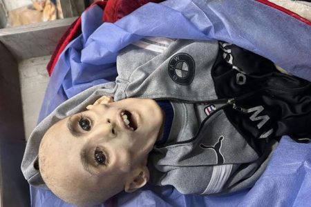 غزہ میں غذائی قلت اور پانی کی کمی وجہ سے 18 کم سن بچے شہید