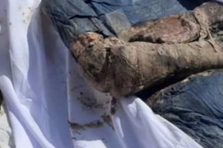 ناصر ہسپتال میں 20 سے زائد فلسطینیوں کو زندہ دفن کیا گیا:یو این